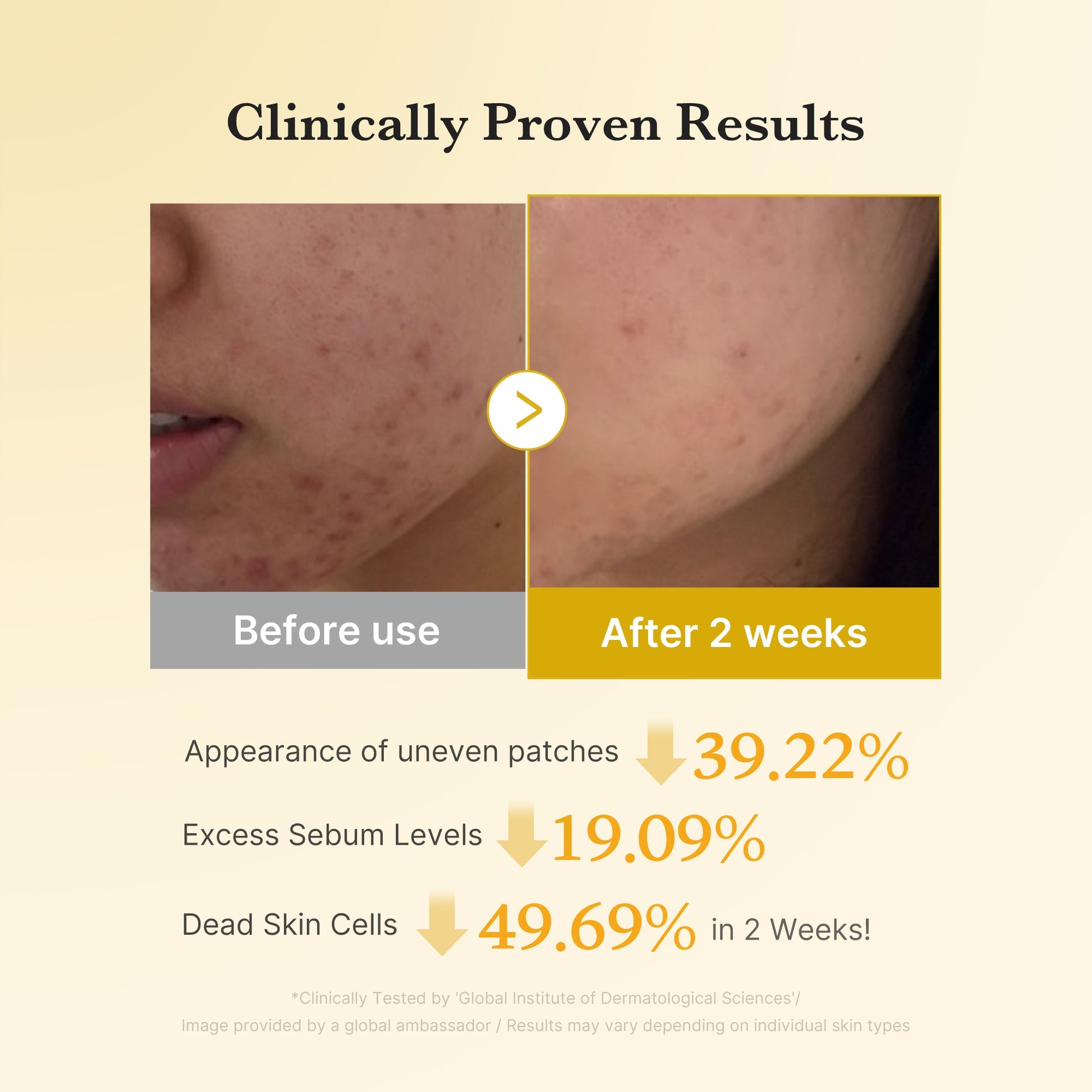 Medicube Kojic Acid Turmeric Pad texture