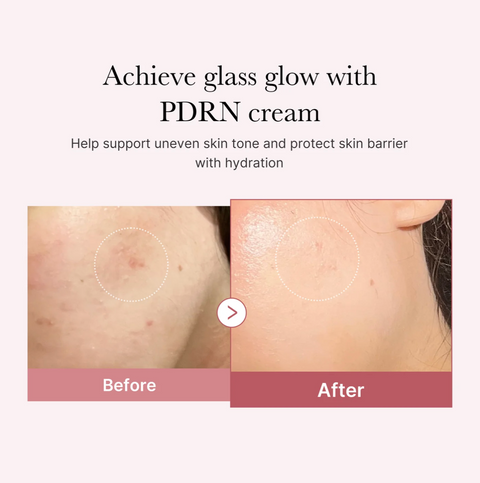 PDRN Pink hyaluronic moisturizing cream 50ml