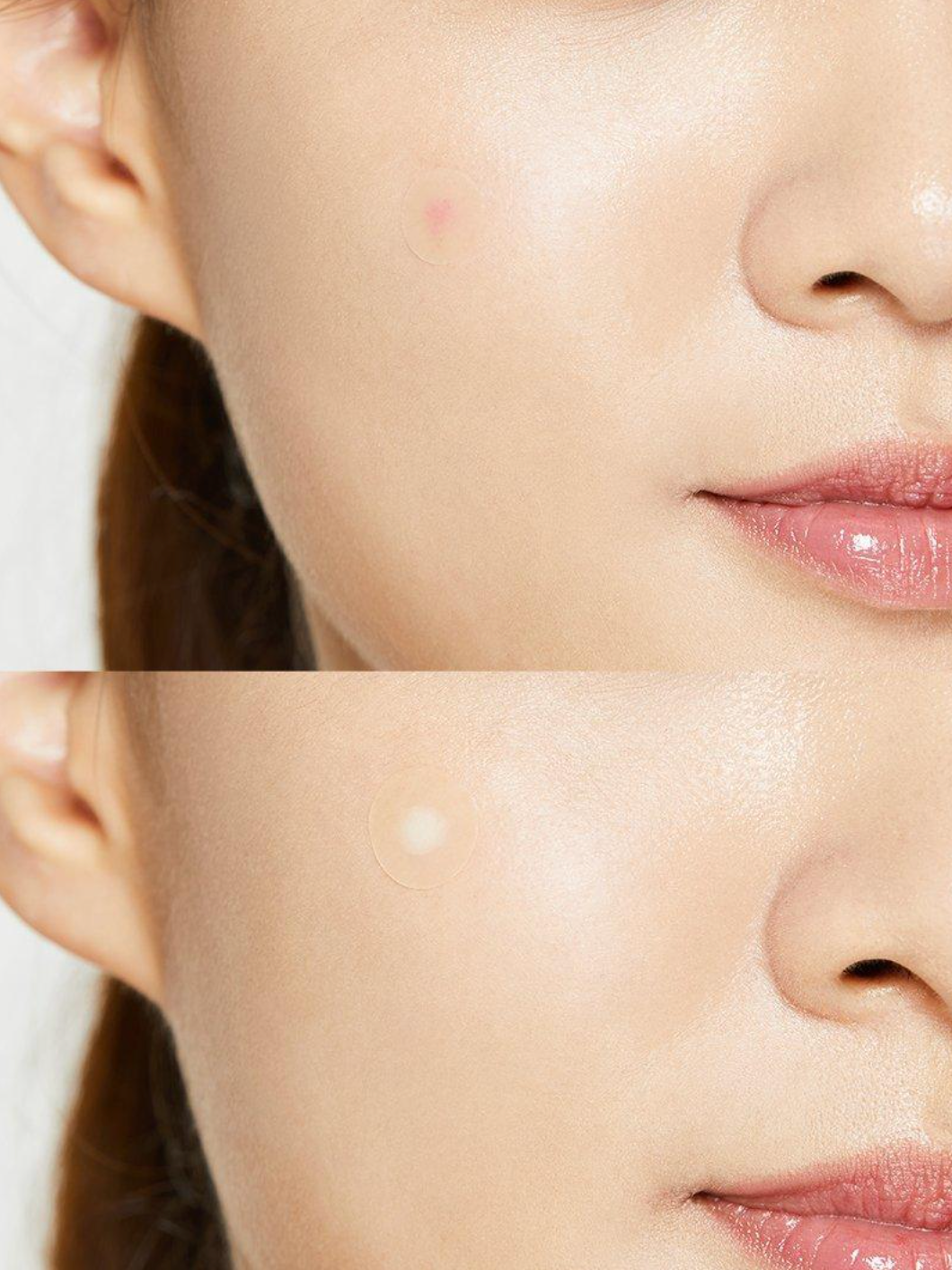 Acne Pimple Master Patch (24patches)