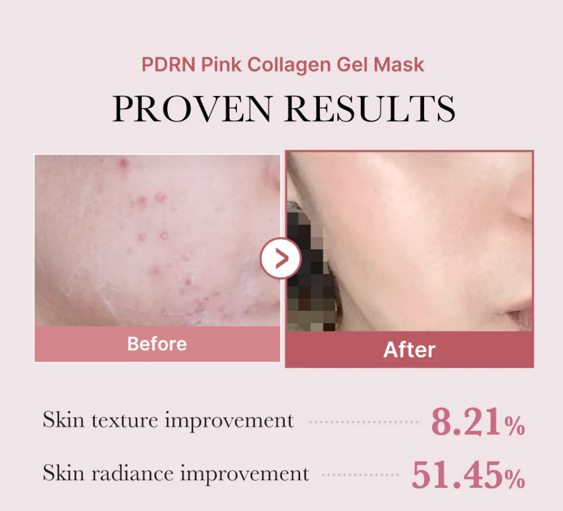 Medicube PDRN Pink Collagen Gel Mask [1EA]