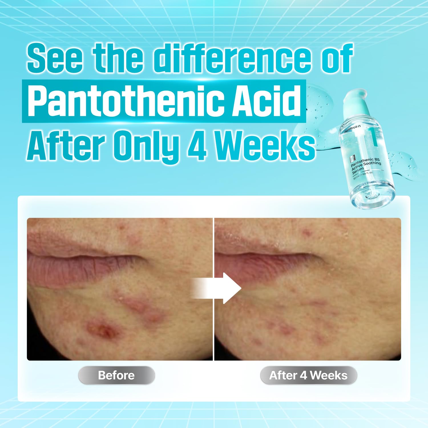 No.1 Pantothenic B5 Active Serum