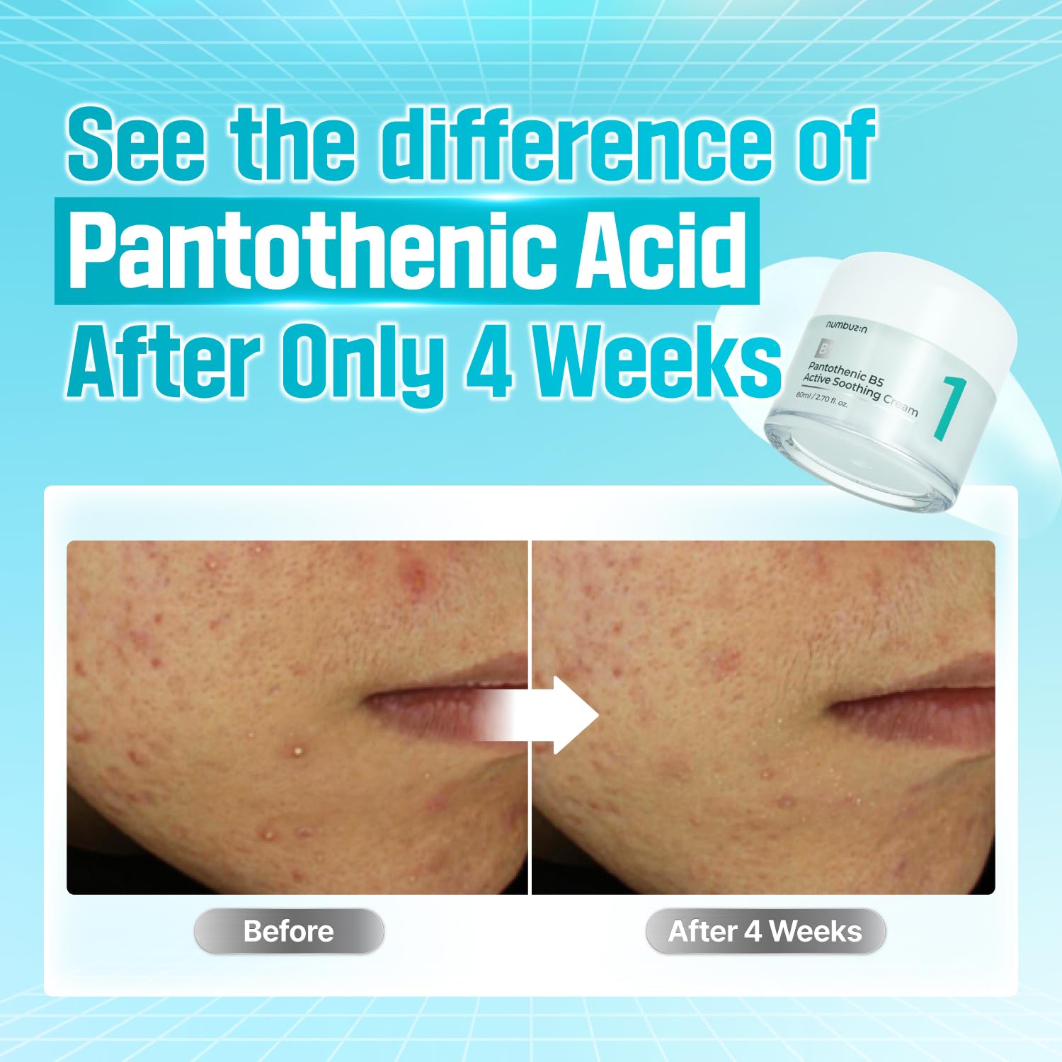 No.1 Pantothenic B5 Active Cream