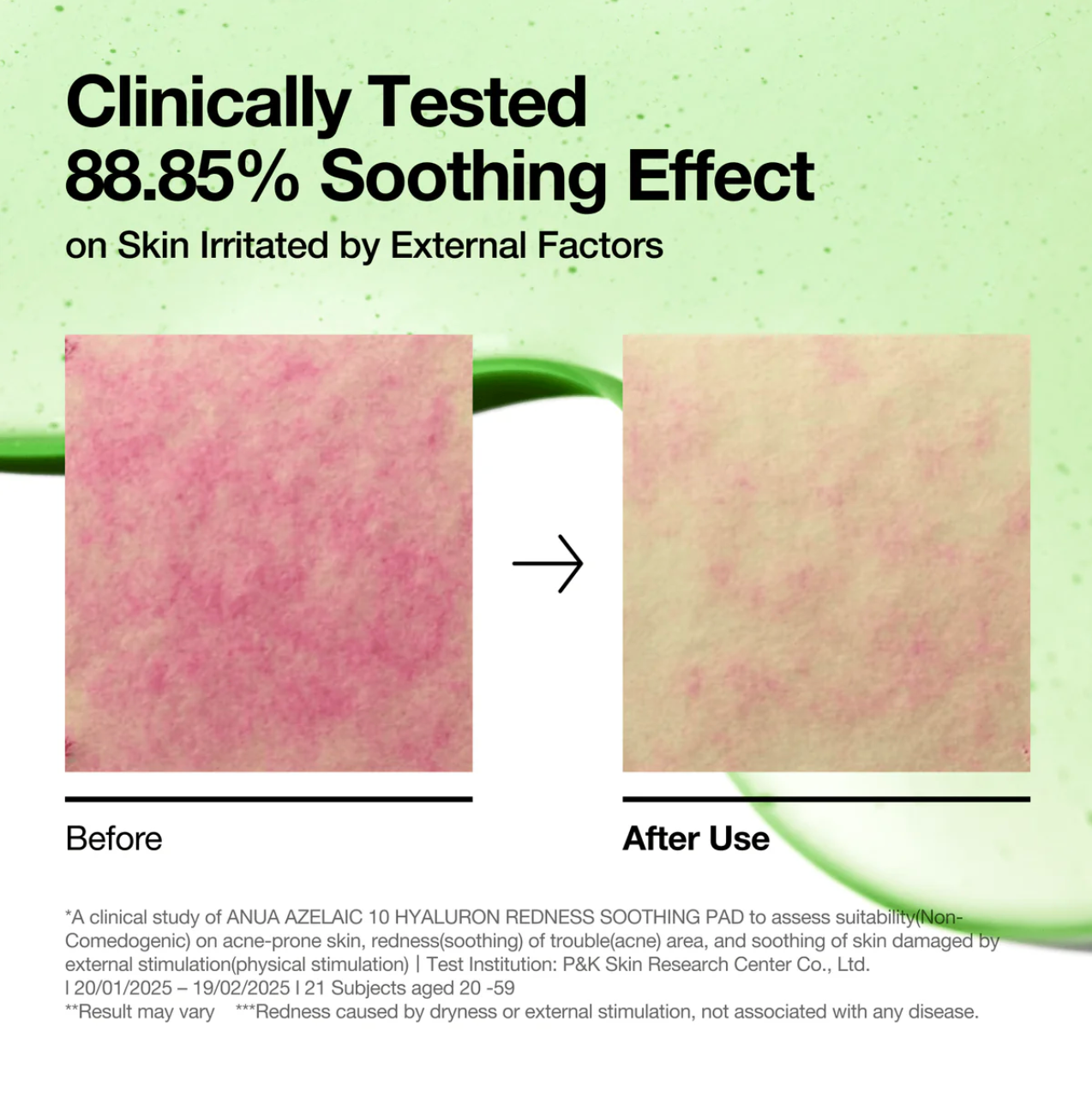 ANUA  Azelaicacid 10 + Hyaluron Soothing pad 90ea - Suunsu Korean skincare