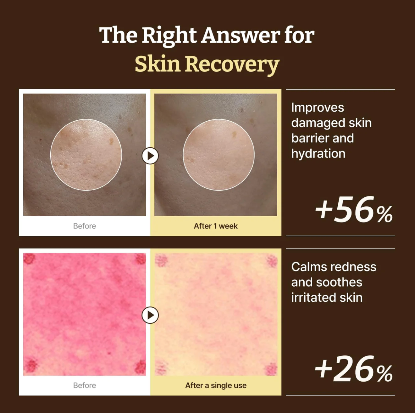 Dr.Reju-All Advanced PDRN Rejuvenating cream 20ml - Suunsu Korean skincare