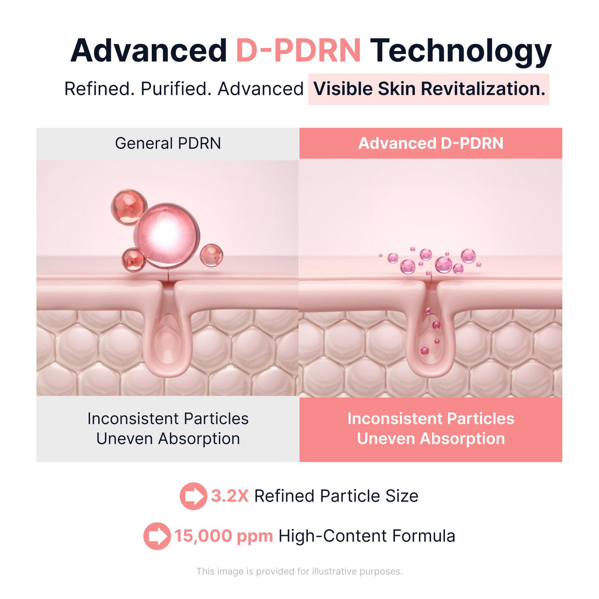 Sungboon Editor advanced D-PDRN technology